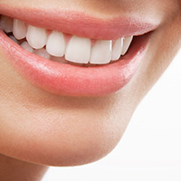 Close-up of woman’s beautiful smile after receiving veneers