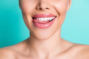 Close-up of woman’s smile after cosmetic treatment