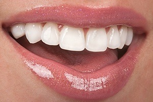 Closeup of bright smile after in office teeth whitening