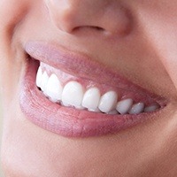 Closeup of bright white smile after deep bleaching