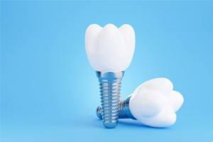 Two dental implants and crowns against blue background