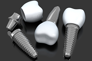 Three animated dental implant supported replacement teeth