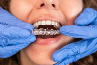 Woman getting Invisalign