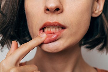 Woman with gum irritation