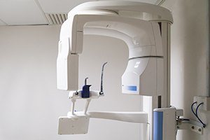 3 D C T cone beam scanner