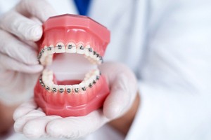 Gloved hands holding dental model with traditional braces