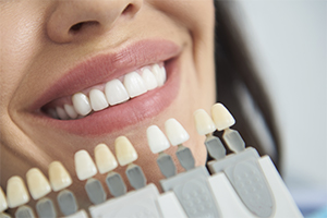 Closeup of smile compared to porcelain veneer shade chart