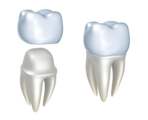 CEREC crowns in Bloomfield provide a same-day solution when you work with Family Dental Practice of Bloomfield. 
